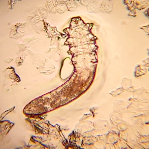 Human Follicle Mite