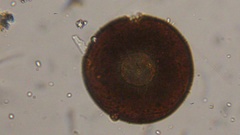 Arcellinida