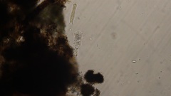 Gastrotricha