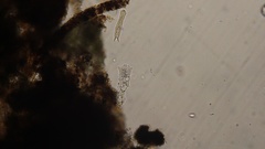 Gastrotricha