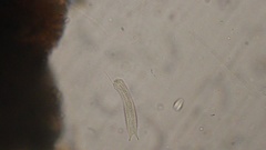 Gastrotricha