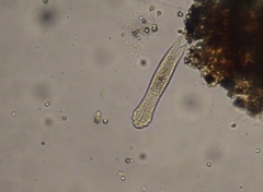 Gastrotricha