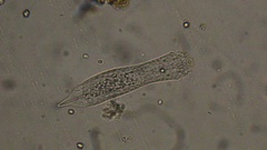 Gastrotricha