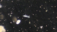 Gastrotricha