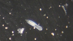 Gastrotricha
