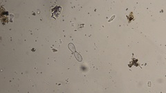 Euglypha