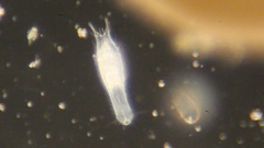 Gastrotricha