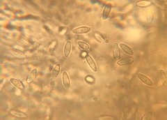 Rhizopogon pseudoroseolus