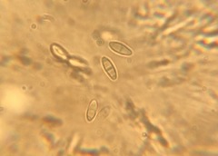 Rhizopogon pseudoroseolus