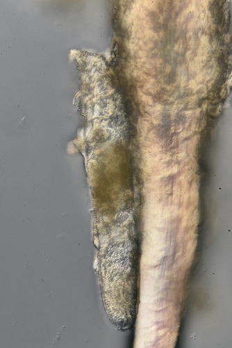 Human Follicle Mite