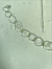 Sphagnum subsecundum