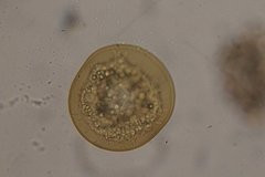 Arcellinida