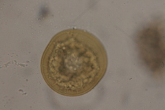 Arcellinida