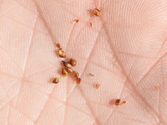 Rhynchospora globularis