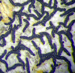 Opegrapha intertexta