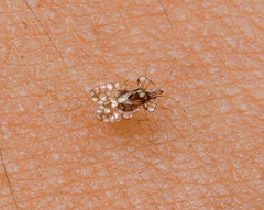 Aconchus urbanus