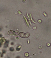 Tetradesmus