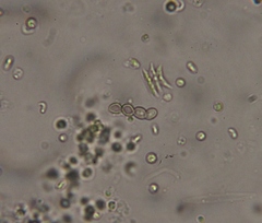 Tetradesmus