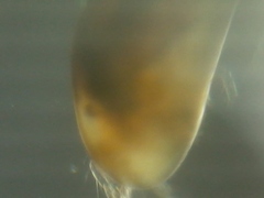 Ostracoda