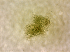 Dicranoloma dicarpum