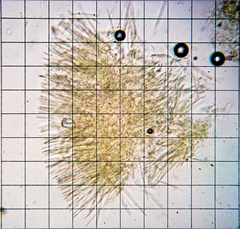 Capitotricha bicolor