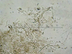 Coprinopsis semitalis