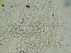 Coprinopsis semitalis