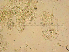 Coprinopsis semitalis