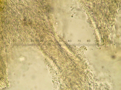 Calcipostia guttulata