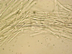 Calcipostia guttulata