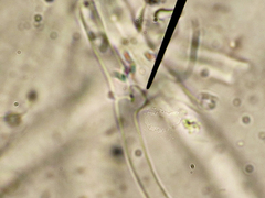 Calcipostia guttulata