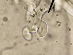 Calcipostia guttulata