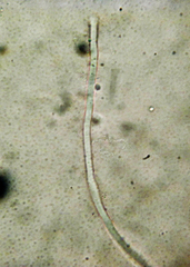Calcipostia guttulata