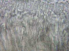 Ascocoryne sarcoides image