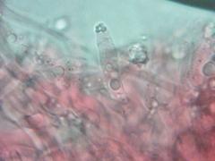 Podoscypha ravenelii