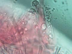 Podoscypha ravenelii