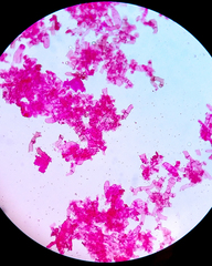 Tomentella bryophila