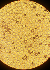 Sphaerosporium lignatile