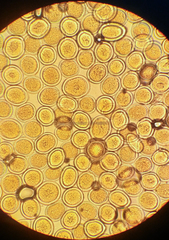 Sphaerosporium lignatile