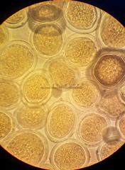 Sphaerosporium lignatile