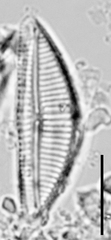 Encyonema