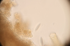 Tatraea macrospora image