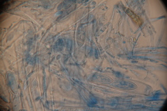 Wynnea americana