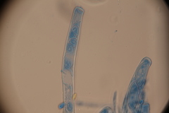 Wynnea americana