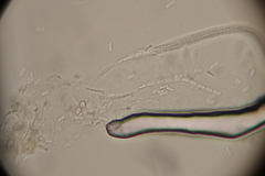 Ophiocordyceps variabilis