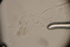 Ophiocordyceps variabilis