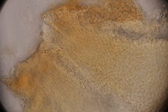 Ophiocordyceps variabilis