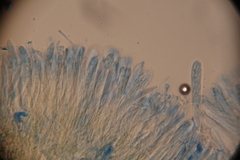 Leotiomycetes