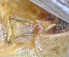 Melanoplus angustipennis