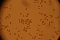 Reticularia splendens